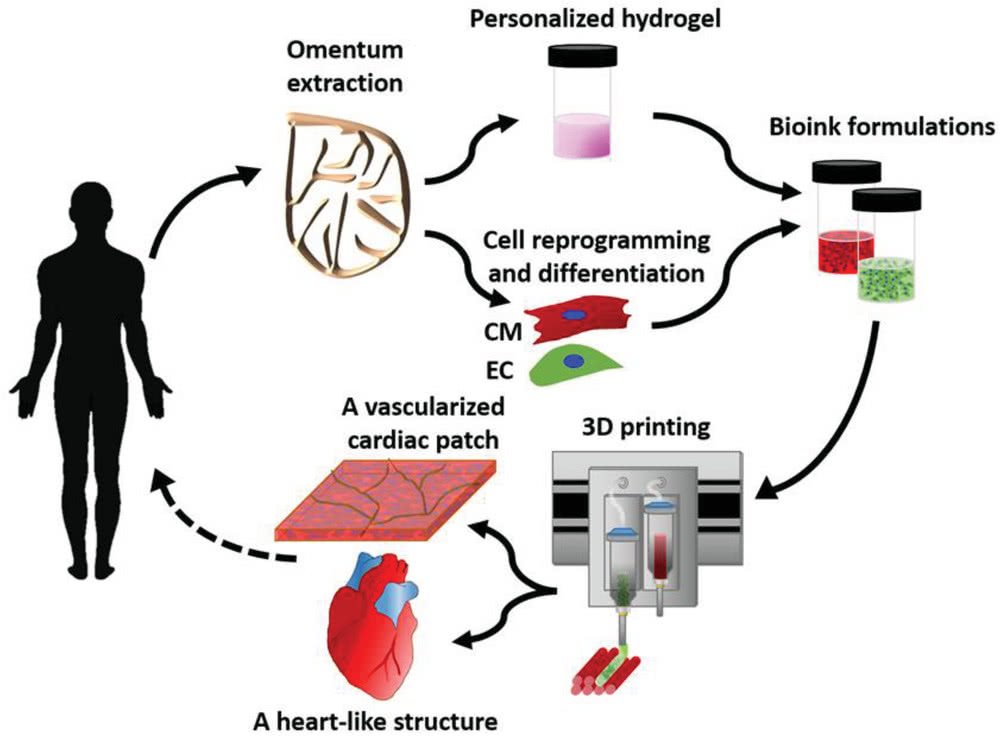 3D-printed heart